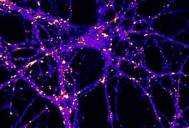 Immunoflurescence image showing bright dots throughout neurons.