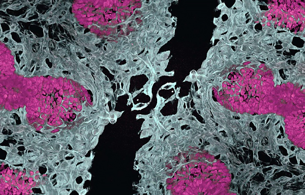 An embryonic mouse lung showing blood vessels (white) and air sacs (pink). 
