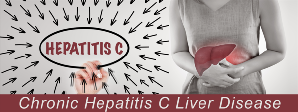 18-DK-0091 Chronic Hepatitis C Liver Disease