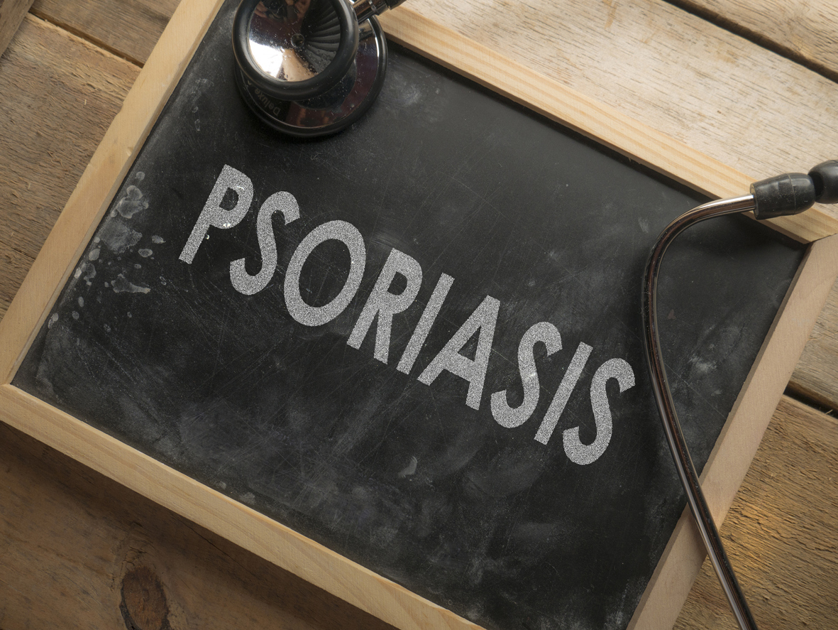 psoriasis