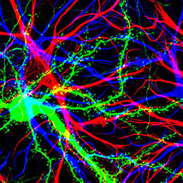 Multiple Sclerosis MS Clinical Digest Brain Cells
