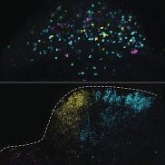 The Mechanoreceptive Ion Channel PIEZO2 Plays a Critical Role in Sexual Function