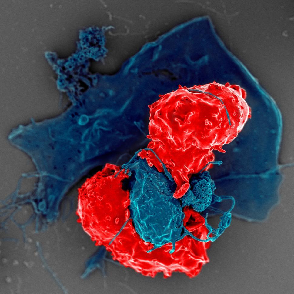 t-regulatory-cells