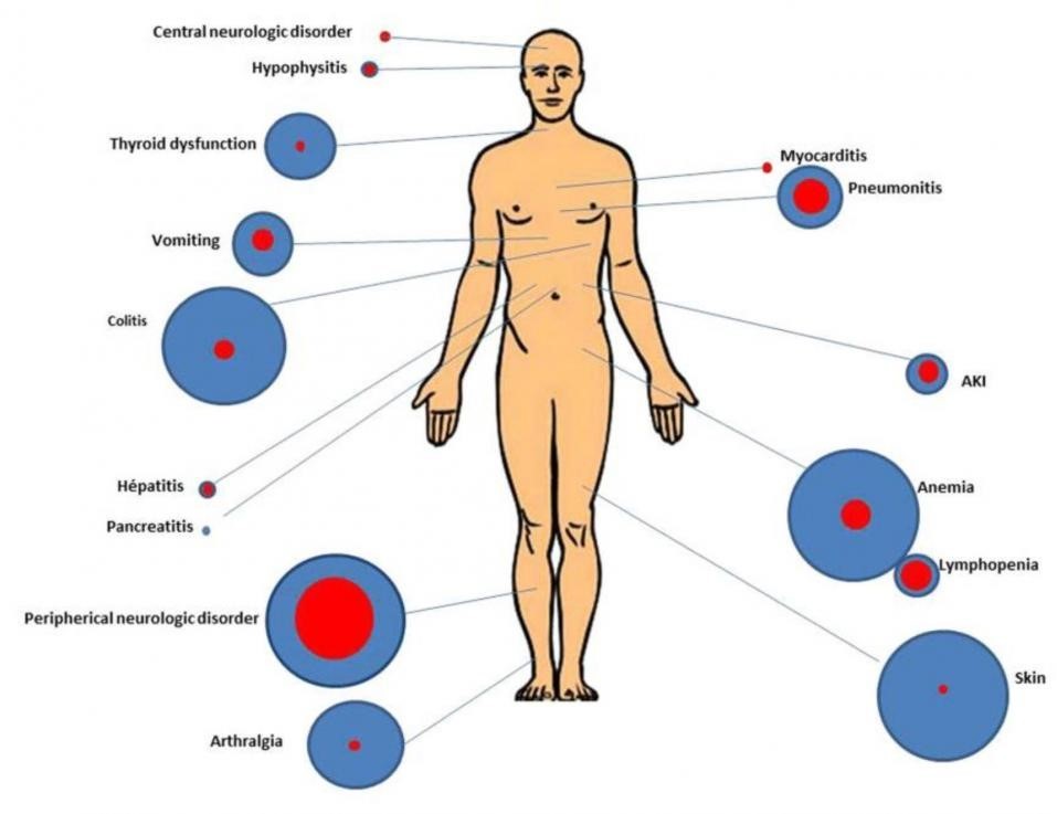 side-effects-of-pd-1-pd-l1-enlarge