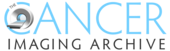 The Cancer Imaging Archive