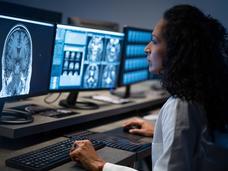  doctor looks at a screen of brain MRI scans