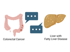 Cancer is more likely to invade the liver when people have fatty liver disease.