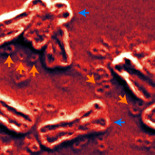 A scanning electron micrograph of a cancer cell nucleus showing chromosomes (blue arrows) with ecDNA (orange arrows) scattered around them. 