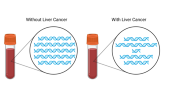 Liver Cancer Fragmentomics Liquid Biopsy