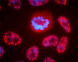 Fluorescent staining of precancer cells