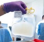 Manufactured CAR T cells ready for infusion into a patient. Credit: Penn Medicine