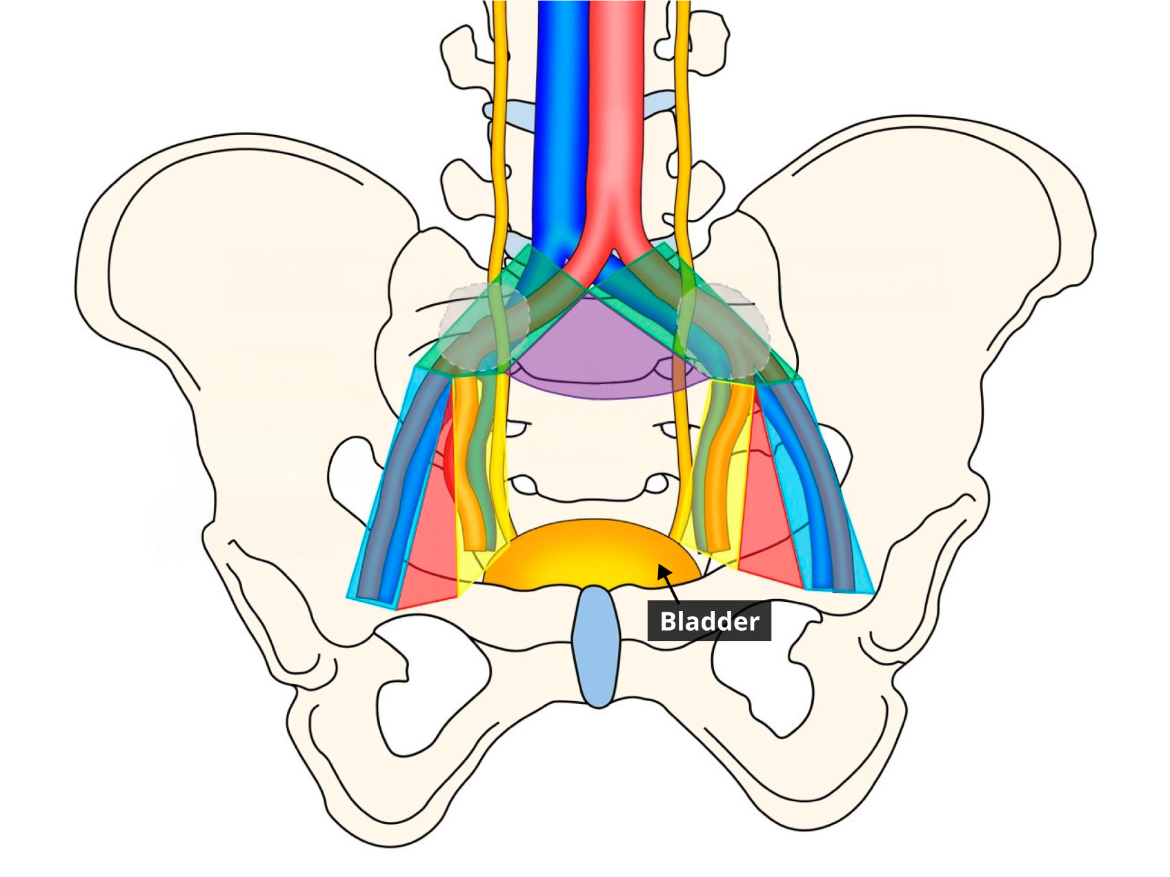 Illustration of the pelvic region showing the bladder with nearby lymph node-containing regions highlighted in different colors.