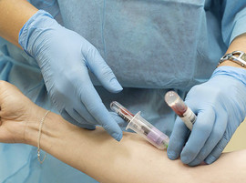 A nurse drawing a patient’s blood, while holding a tube of blood previously drawn for testing.