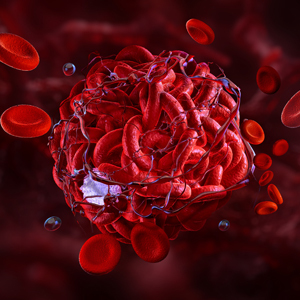 3D rendering of a blood clot within a blood vessel