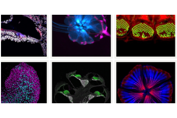 Scientific Art images from NIDCD's Multimedia Library.