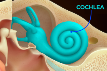 Color illustration of the human inner ear anatomy, with the snail-shaped cochlea labeled.