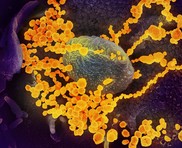 Novel Coronavirus purple yellow