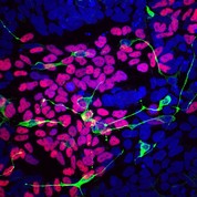 fluorescently labeled cells