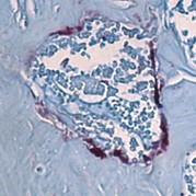 a microscopy image showing maroon-colored bone-degrading cells from a mouse