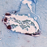 Bone-degrading cells (maroon) in the jawbone marrow of mice lacking microbes