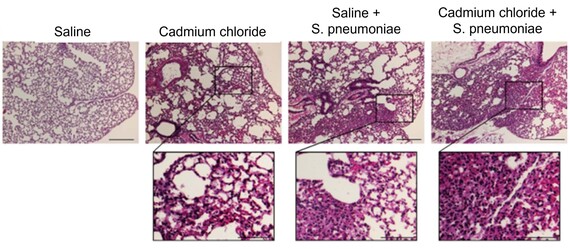 Seven images of mice lungs exposed to saline, cadmium chloride, Saline + S. pheumoniae, and cadmium chloride and S. pneumoniae.