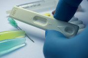 Photo of HIV test