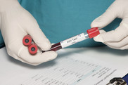 Gloved fingers holding vial of blood labeled "HIV Test"