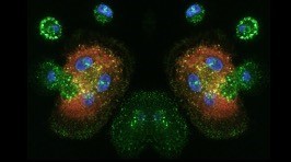 Macrophage Infection by HIV