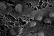 A high-powered black-and-white microscope image showing exosomes, nanosized parts of cells. (Credit: Surya Shrivastava / City of Hope).