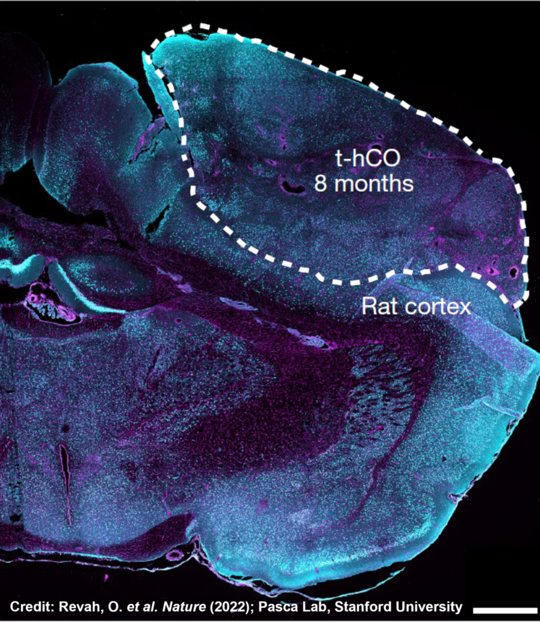 Example of a transplanted human cortical organoid (t-hCO) in the rat cortex. Credit: Revah, O. et al. Nature (2022); Pasca Lab, Stanford