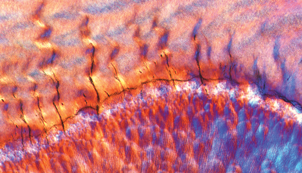 Colored micrograph of a tooth shows small fractures extending from the junction of enamel and dentin. 