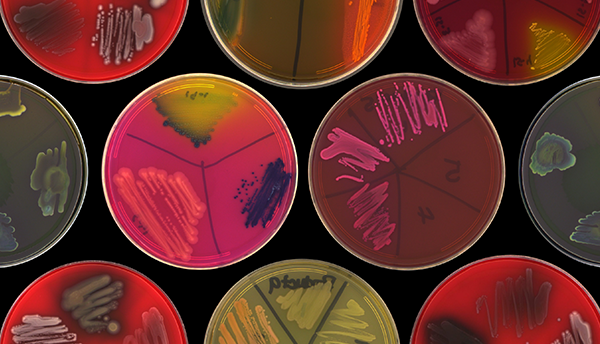 Overhead image shows petri dishes divided into parts with different microbes growing inside. 