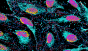 Colorized micrograph shows brightly colored cells in pink and turquoise on black background.