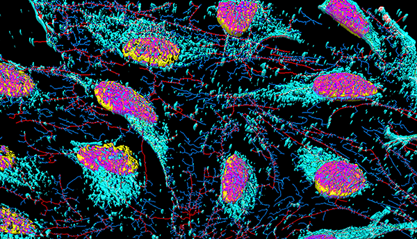 Colorized micrograph shows brightly colored cells in pink and turquoise on black background.