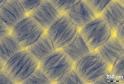Micrograph shows woven polyester mask fibers in diagonal pattern. 