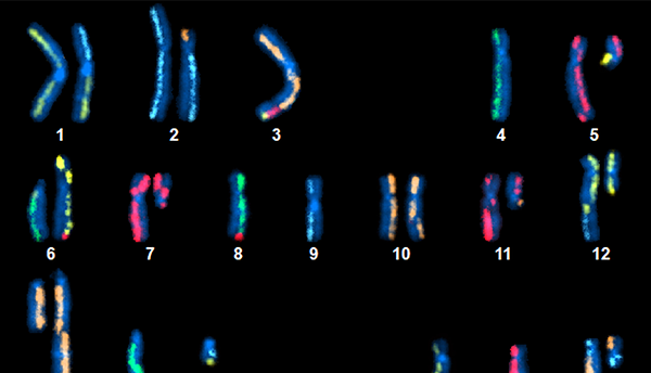 An image showing pairs of numbered and color-coded chromosomes on a black background.