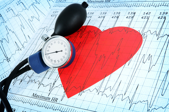 imagen de un corazón sobre un electrocardiograma