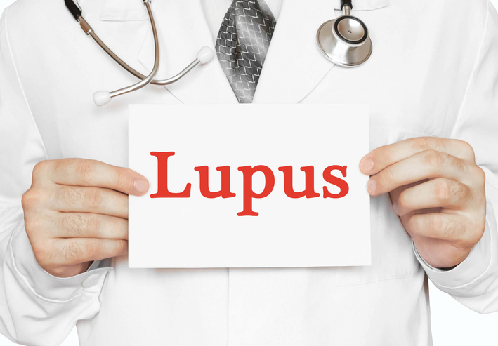 imagen de un medico con un cartel que dice lupus