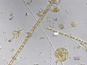 Phytoplankton, NOAA Fisheries/Dr. Judy Li