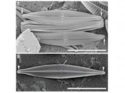 The Browder diatom (Proschkinia browderiana) under a microscope.