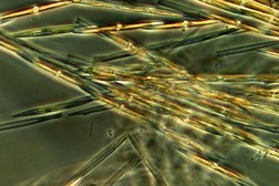 An image of Pseudo-nitzschia under a light microscope, magnified 1,000 times