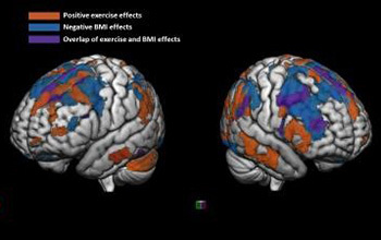 Brain Activity Image