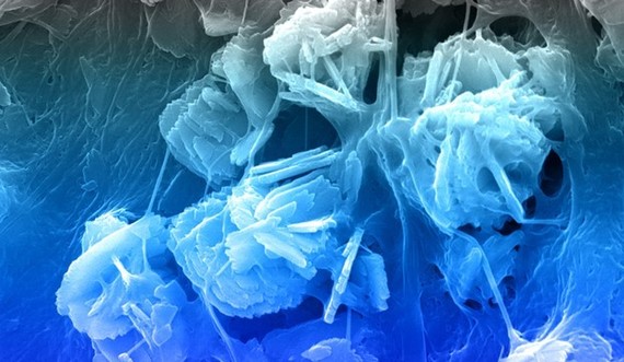 bioengineered bone repair