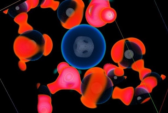 pharmaceuticals iron