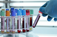 Lab test tubes of blood 