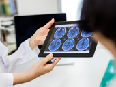medical staff looking at brain images
