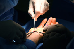 Doctor operating on patient's hand