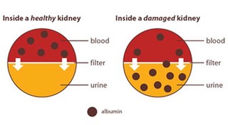 image showing the inside of a kidney