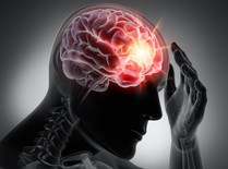 Graphic animation of man having stroke