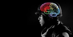 picture of a soldier and brain been x-rayed